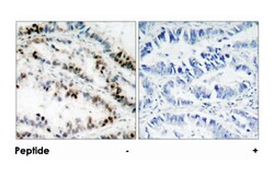 SMC1A (phospho S957), Rabbit anti-Human, Mouse, Polyclonal Antibody, Abnova 100 &mu;g | Buy Online | Abnova | Fisher Scientific