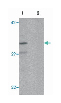 CLEC2A, Rabbit, Polyclonal Antibody, Abnova 100 &mu;g | Buy Online | Abnova Corporation | Fisher Scientific