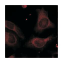 NFKB1 (phospho S927), Rabbit anti-Human, Mouse, Rat, Polyclonal Antibody,
