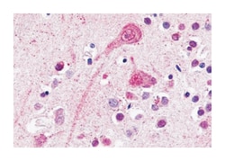 BDKRB2, Rabbit, Polyclonal Antibody, Abnova 50&mu;g; Unlabeled:Antibodies,