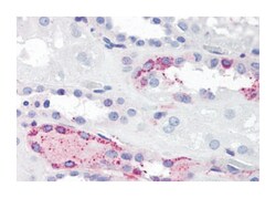 LPAR4 Rabbit anti-Bovine, Dog, Human, Pig, Rabbit, Polyclonal Antibody, Abnova 50 &mu;g | Buy Online | Abnova Corporation | Fisher Scientific