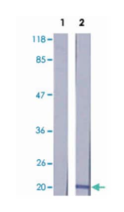 MRCL3, Rabbit, Polyclonal Antibody, Abnova 100 &mu;g | Buy Online | Abnova | Fisher Scientific