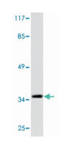 CEBPB Rabbit anti-Human, Mouse, Rat, Polyclonal Antibody, Abnova 100&mu;L;