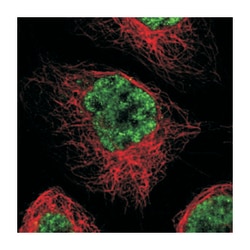 MAGEB17, Rabbit, Polyclonal Antibody, Abnova 100μL; Unlabeled:Antibodies,