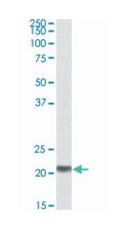 C20orf20, Goat, Polyclonal Antibody, Abnova 100&mu;g; Unlabeled:Antibodies,