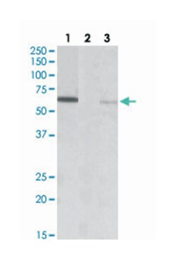 MKRN1, Goat, Polyclonal Antibody, Abnova 100 &mu;g | Buy Online | Abnova Corporation | Fisher Scientific