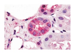 VN1R1 Rabbit anti-Human, Polyclonal Antibody, Abnova 50&mu;g; Unlabeled:Antibodies,