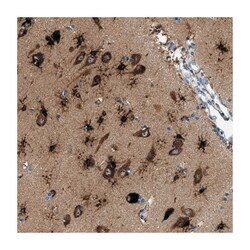 PFKP Rabbit anti-Human, Polyclonal Antibody, Abnova 100&mu;L; Unlabeled:Antibodies,