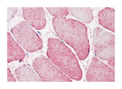 SEMA4B, Rabbit, Polyclonal Antibody, Abnova 50 &mu;g | Buy Online | Abnova Corporation | Fisher Scientific