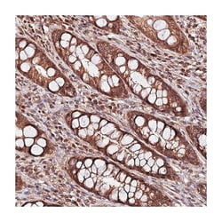 PDE4D Rabbit anti-Human, Polyclonal Antibody, Abnova 100&mu;L; Unlabeled:Antibodies,