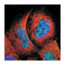 SMC1B, Rabbit, Polyclonal Antibody, Abnova 100&mu;L; Unlabeled:Antibodies,