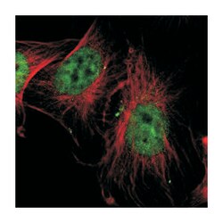 SP1 Rabbit anti-Human, Polyclonal Antibody, Abnova 100&mu;L; Unlabeled:Antikörper