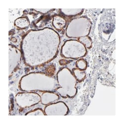 CALR Rabbit anti-Human, Mouse, Rat, Polyclonal Antibody, Abnova 100 &mu;L | Buy Online | Abnova Corporation | Fisher Scientific