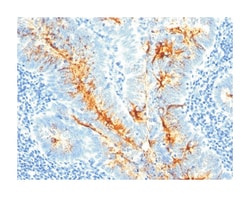 DSG1, Mouse, Clone: CC49, Abnova 100&mu;g; Unlabeled:Anticorps, Monoclonal