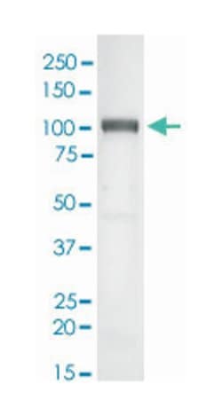 CD276, Rabbit, Clone: SP206, Abnova 100&mu;L; Unlabeled:Antibodies, Monoclonal
