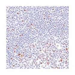 CCND3, Rabbit, Clone: SP207, Abnova 100&mu;L; Unlabeled:Antibodies, Monoclonal