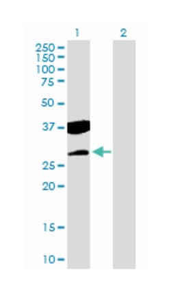 CTD (carboxy-terminal domain, RNA polymerase II, polypeptide A) small phosphatase