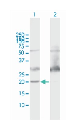ATP5H, Mouse, Purified MaxPab Polyclonal Antibody, Abnova 50&mu;g; Unlabeled:Antibodies,