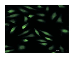 zinc finger protein 274, Mouse, Clone: 2F5, Abnova 100 &mu;g | Buy Online | Abnova | Fisher Scientific