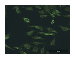 peroxiredoxin 3, Rabbit, Purified MaxPab™ Polyclonal Antibody, Abnova™