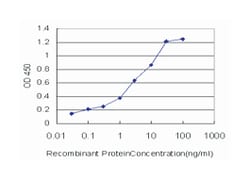 sirtuin (silent mating type information regulation 2 homolog) 1 (S. cerevisiae),