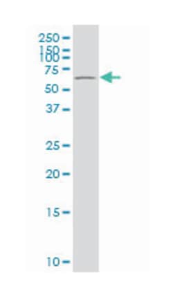 POT1 protection of telomeres 1 homolog (S. pombe), Mouse, Polyclonal Antibody,