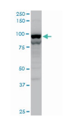 transportin 2, Mouse, Polyclonal Antibody, Abnova&trade;