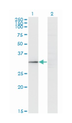 GIMAP5, Mouse, Clone: 3F11, Abnova 200&mu;L; Unlabeled:Antibodies, Monoclonal