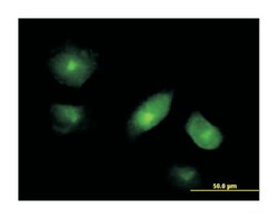 VAC14, Mouse, Purified MaxPab Polyclonal Antibody, Abnova 50&mu;g; Unlabeled:Antibodies,