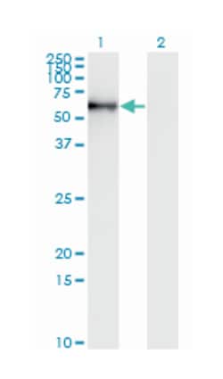 STK33, Mouse, Clone: 4F7, Abnova 200 &mu;L | Buy Online | Abnova Corporation | Fisher Scientific