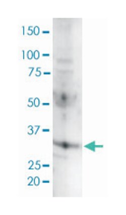 CCND3, Rabbit, Clone: SP207, Abnova 100&mu;L; Unlabeled:Antibodies, Monoclonal