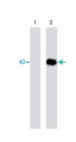 DAG1, Mouse, Clone: M117, Abnova 100&mu;L; Unlabeled:Anticuerpos