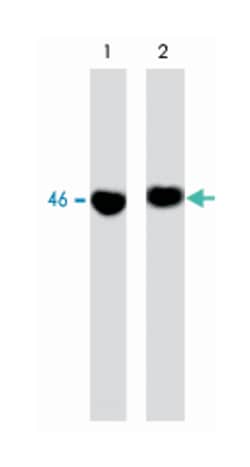 GSK3B, Mouse, Clone: M131, Abnova 100&mu;L; Unlabeled:Antibodies, Monoclonal