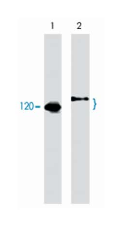 CBL, Mouse, Clone: M159, Abnova 100&mu;L; Unlabeled:Antibodies, Monoclonal