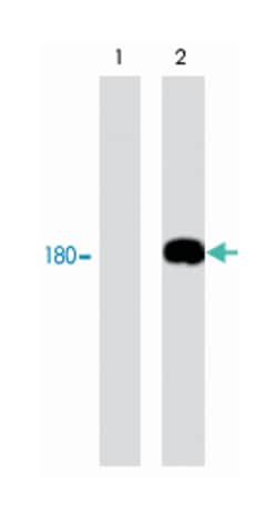 EGFR, Mouse, Clone: M199, Abnova 100&mu;L; Unlabeled:Antibodies, Monoclonal