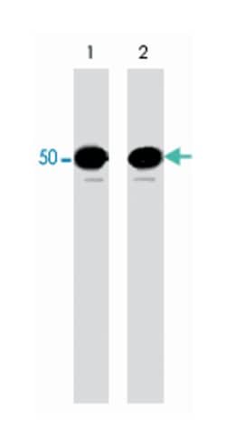 Cdh1, Mouse, Clone: M168, Abnova 100&mu;L; Unlabeled:Antibodies, Monoclonal