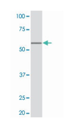 TP53, Rabbit, Clone: S11-K, Abnova 50&mu;L; Unlabeled:Antibodies, Monoclonal