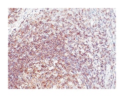 PTPRC, Rabbit, Clone: E19-G, Abnova 100&mu;L; Unlabeled:Antibodies, Monoclonal