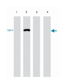 Vitellogenin (VTG), Mouse, Clone: 1G2, Abnova 100&mu;g; Unlabeled:Antibodies,