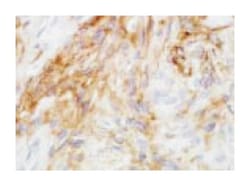 MFH, Mouse, Clone: A3, Abnova 50&mu;g; Unlabeled:Antibodies, Monoclonal