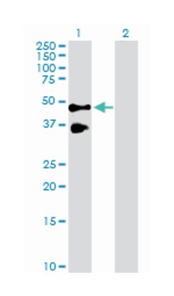 tumor necrosis factor receptor superfamily, member 10b, Rabbit, Purified