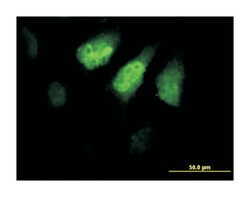 zinc finger protein 259 (B01), Mouse anti-Human, Polyclonal Antibody, Abnova
