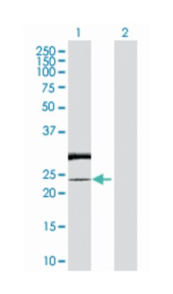 RAB7, member RAS oncogene family-like 1, Rabbit, Purified MaxPab Polyclonal Antibody, Abnova 100 &mu;g | Buy Online | Abnova Corporation | Fisher Scientific