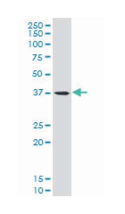 rhomboid, veinlet-like 1 (Drosophila), Mouse, Polyclonal Antibody, Abnova