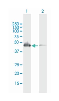 SH2D2A, Mouse, Polyclonal Antibody, Abnova 50&mu;L; Unlabeled:Antibodies,