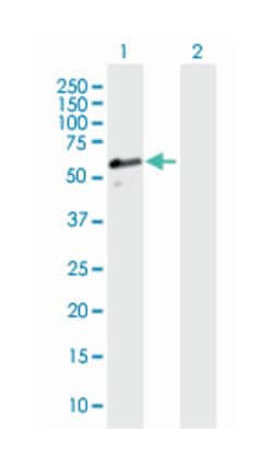 DnaJ (Hsp40) homolog, subfamily A, member 3, Mouse, Polyclonal Antibody, Abnova&trade;