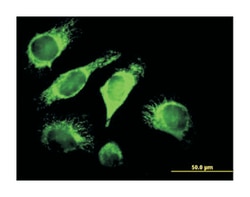 DnaJ (Hsp40) homolog, subfamily A, member 3, Mouse, Polyclonal Antibody, Abnova&trade;