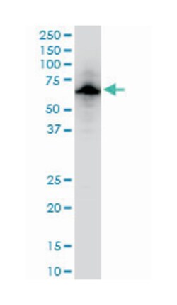 ubiquitin specific peptidase 14 (tRNA-guanine transglycosylase) (A01),