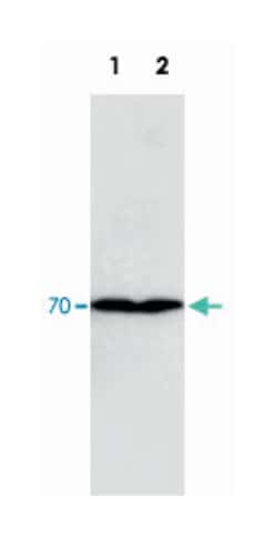 COL3A1, Mouse, Clone: COL-29, Abnova 100&mu;g; Unlabeled:Antibodies, Monoclonal