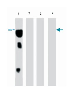 Vitellogenin (VTG), Mouse, Clone: 5A4, Abnova 100&mu;g; Unlabeled:Antibodies,